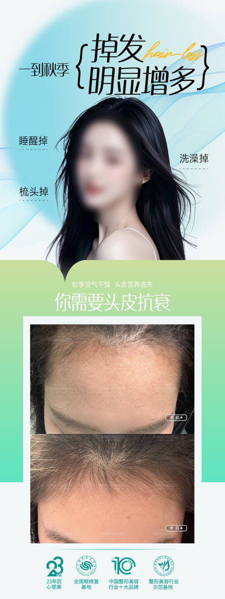 源文件下载【享设计】搜索编号：49420034164746918【头皮抗衰活动海报】