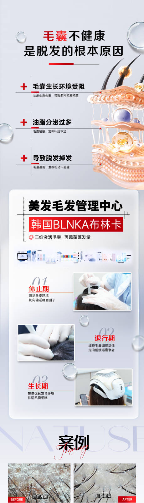 源文件下载【享设计】搜索编号：86020033825561712【医美韩国布林卡毛发管理创意图2】