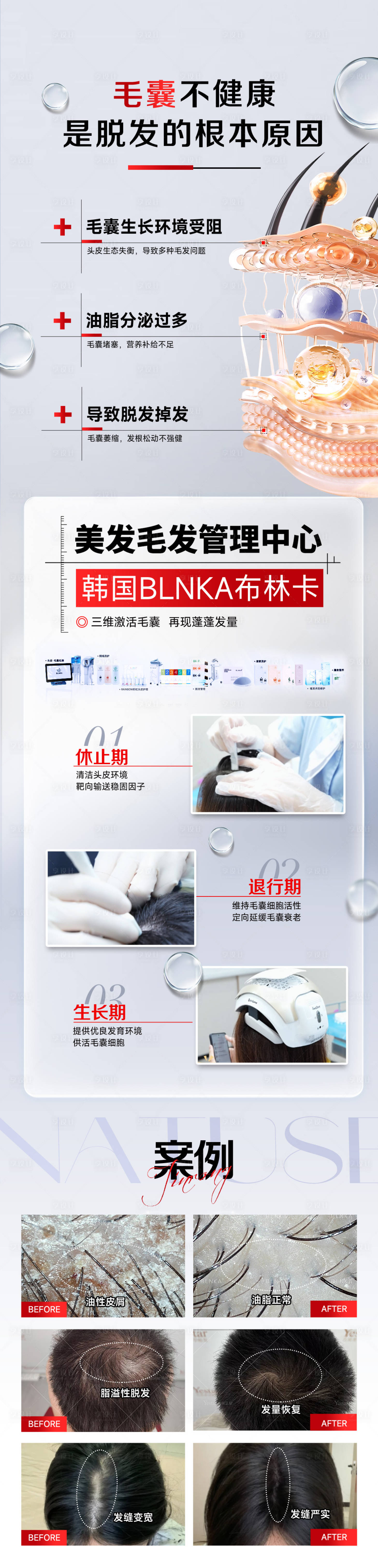 源文件下载【享设计】搜索编号：86020033825561712【医美韩国布林卡毛发管理创意图2】