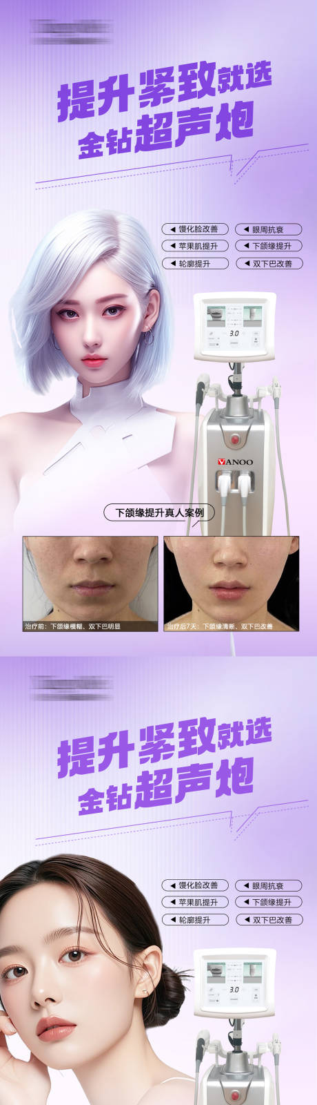 源文件下载【享设计】搜索编号：28730034241527107【金钻超声炮品宣案例】