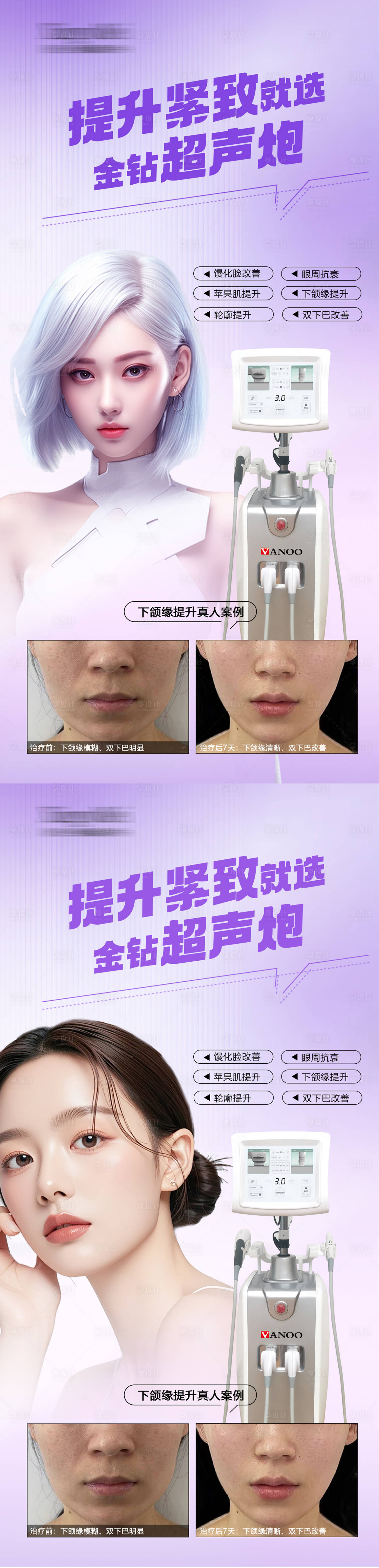 源文件下载【享设计】搜索编号：28730034241527107【金钻超声炮品宣案例】