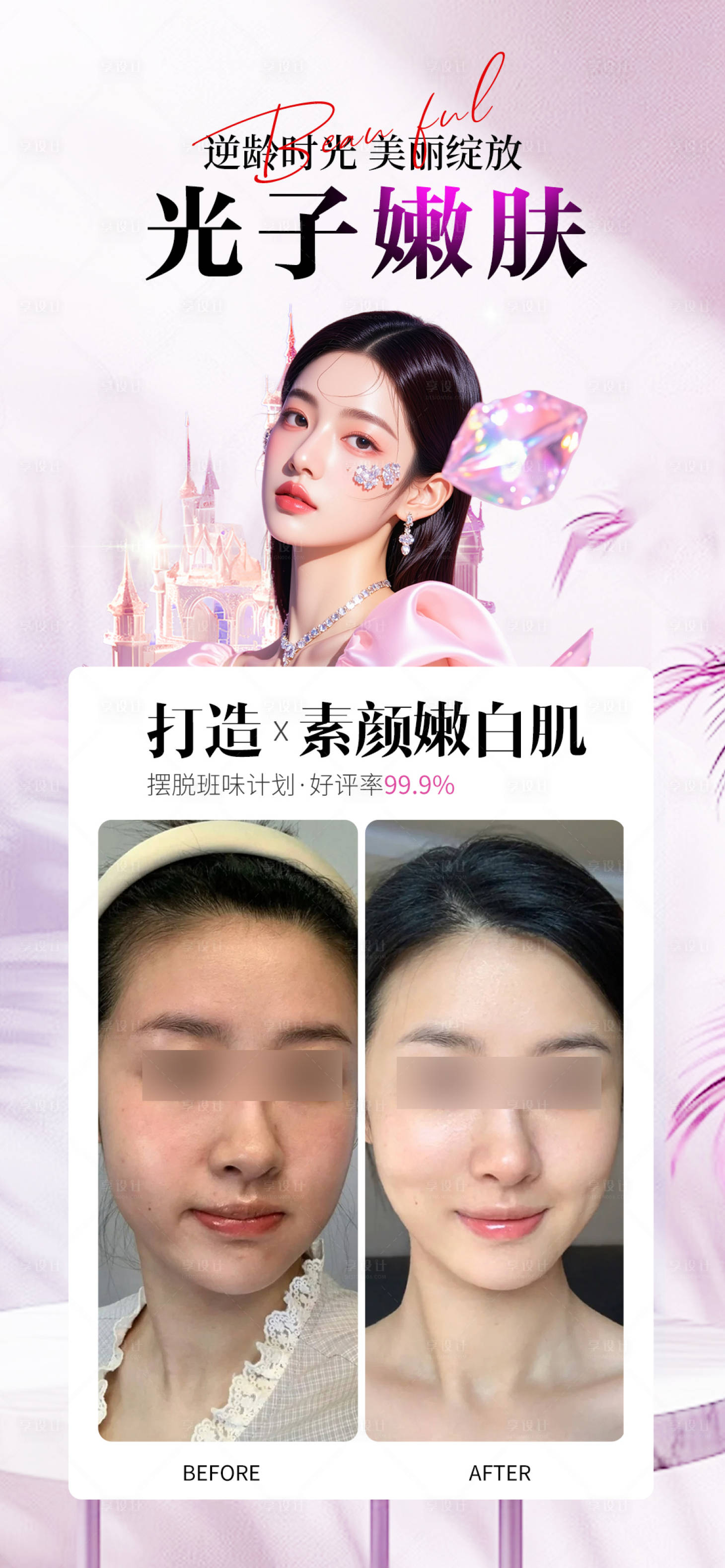 源文件下载【享设计】搜索编号：15630033821589438【光子嫩肤案例】