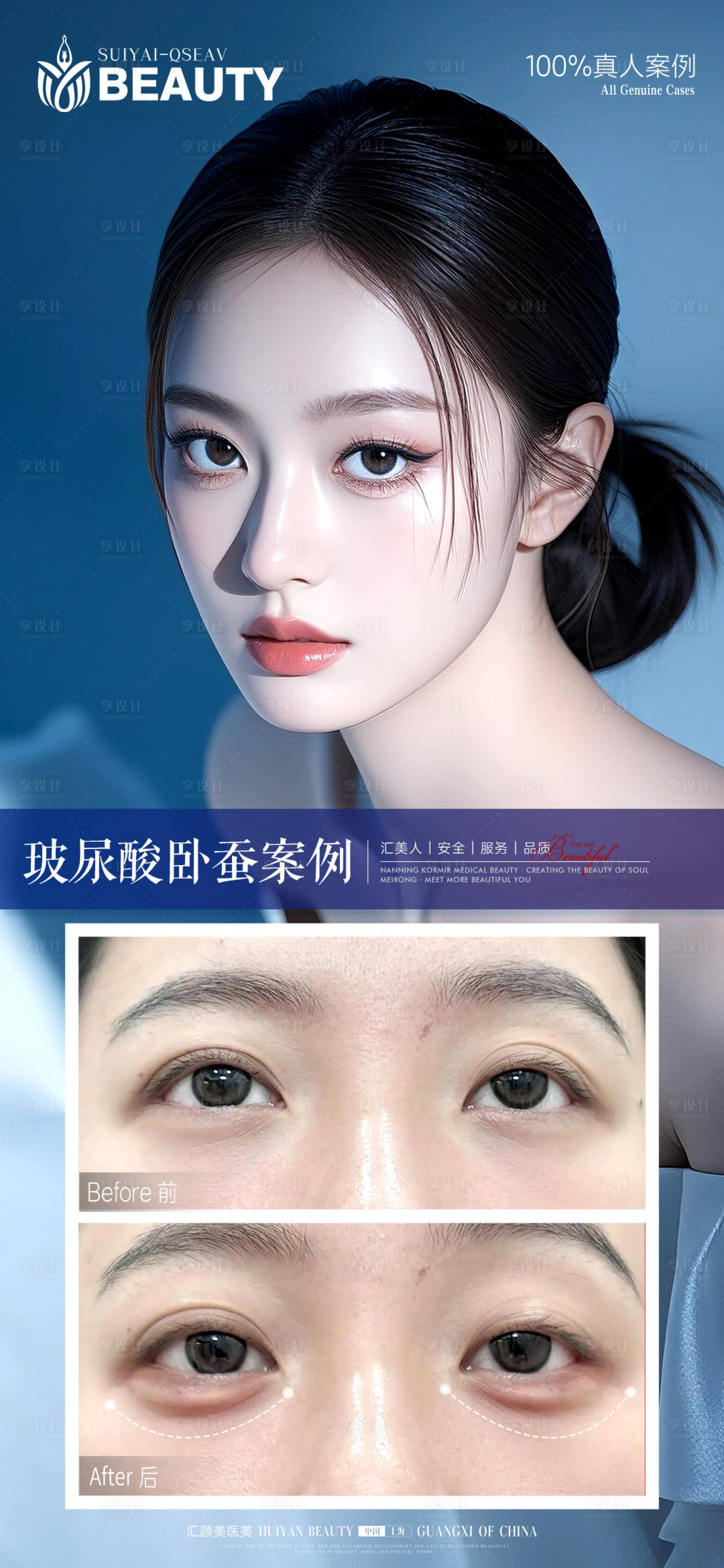 源文件下载【享设计】搜索编号：47230033925857701【丰卧蚕案例】