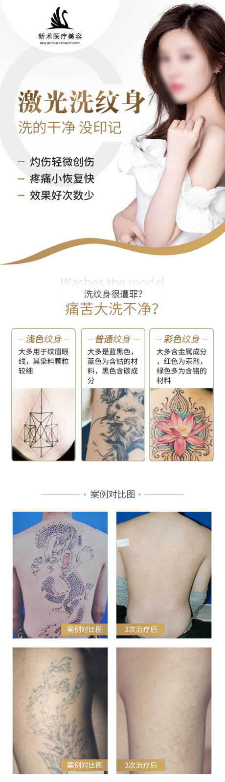 源文件下载【享设计】搜索编号：50140033940741537【激光洗纹身电商详情页】