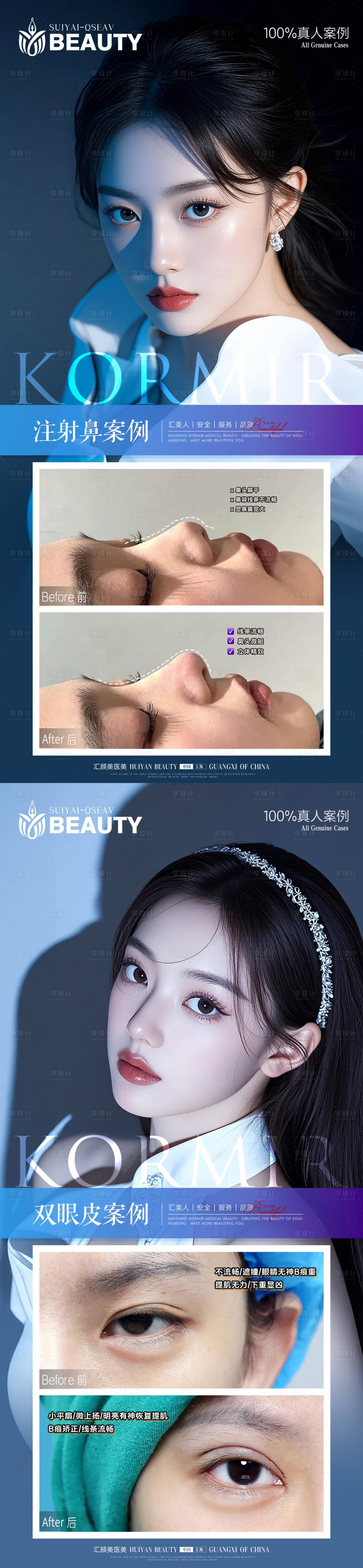 源文件下载【享设计】搜索编号：22180034139161765【医美案例】