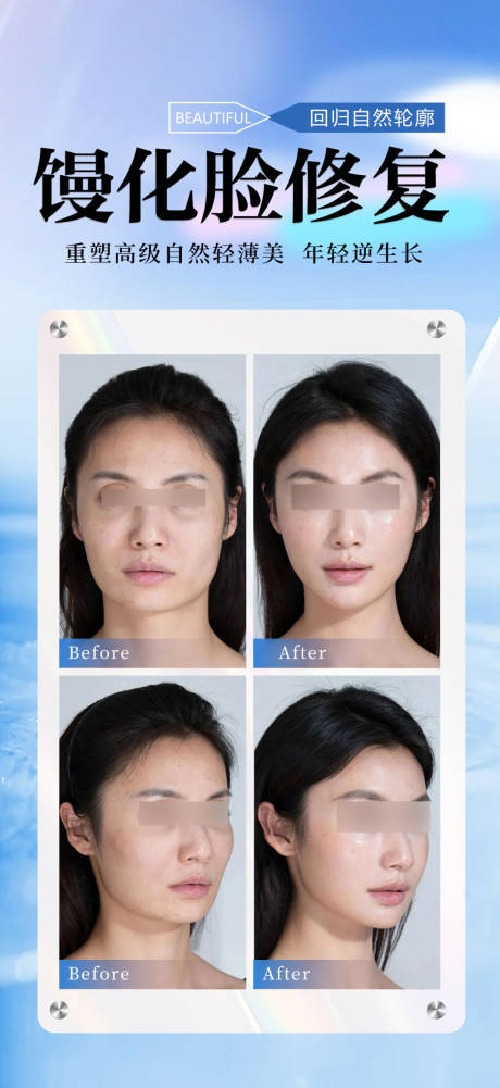 源文件下载【享设计】搜索编号：87070034045671738【馒化脸修复】