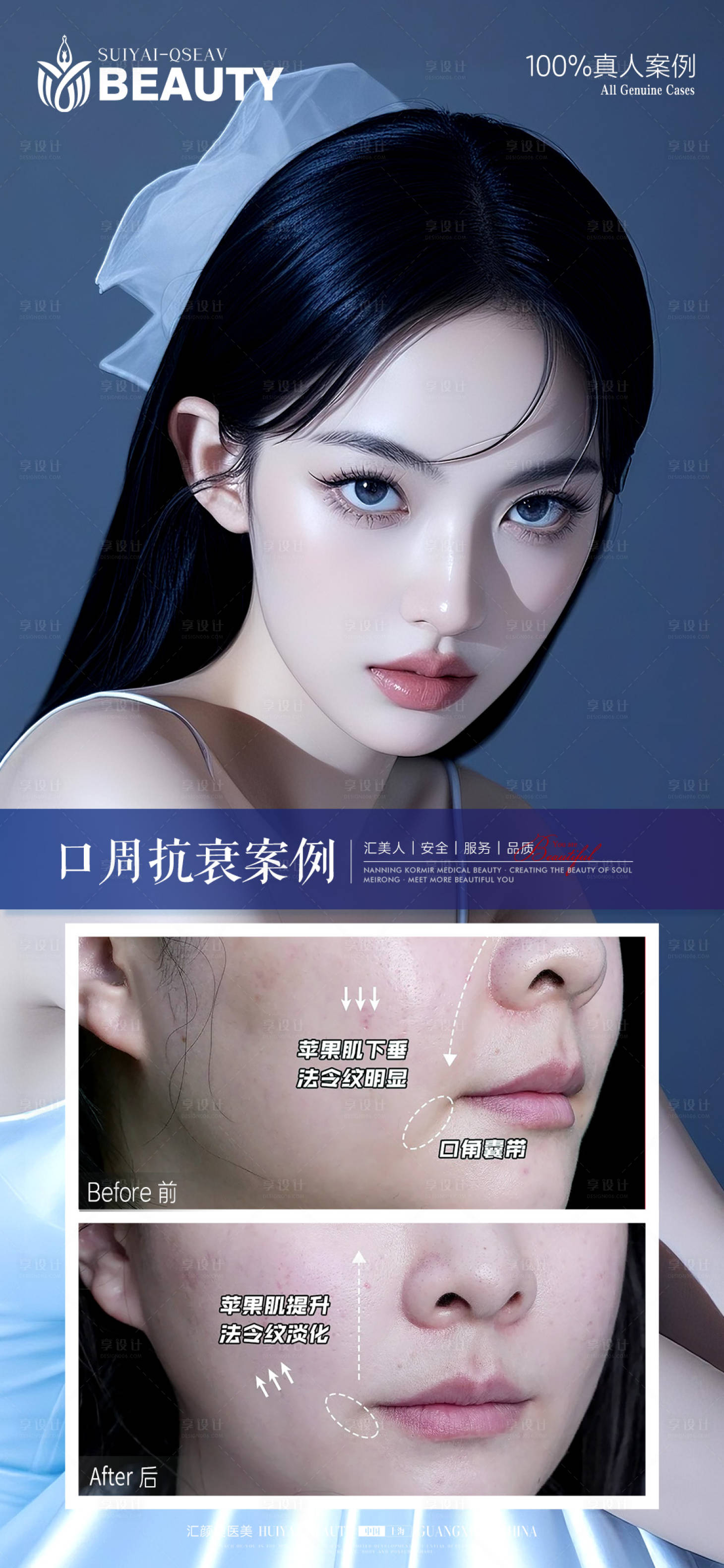 源文件下载【享设计】搜索编号：44190033926644397【口周抗衰案例】