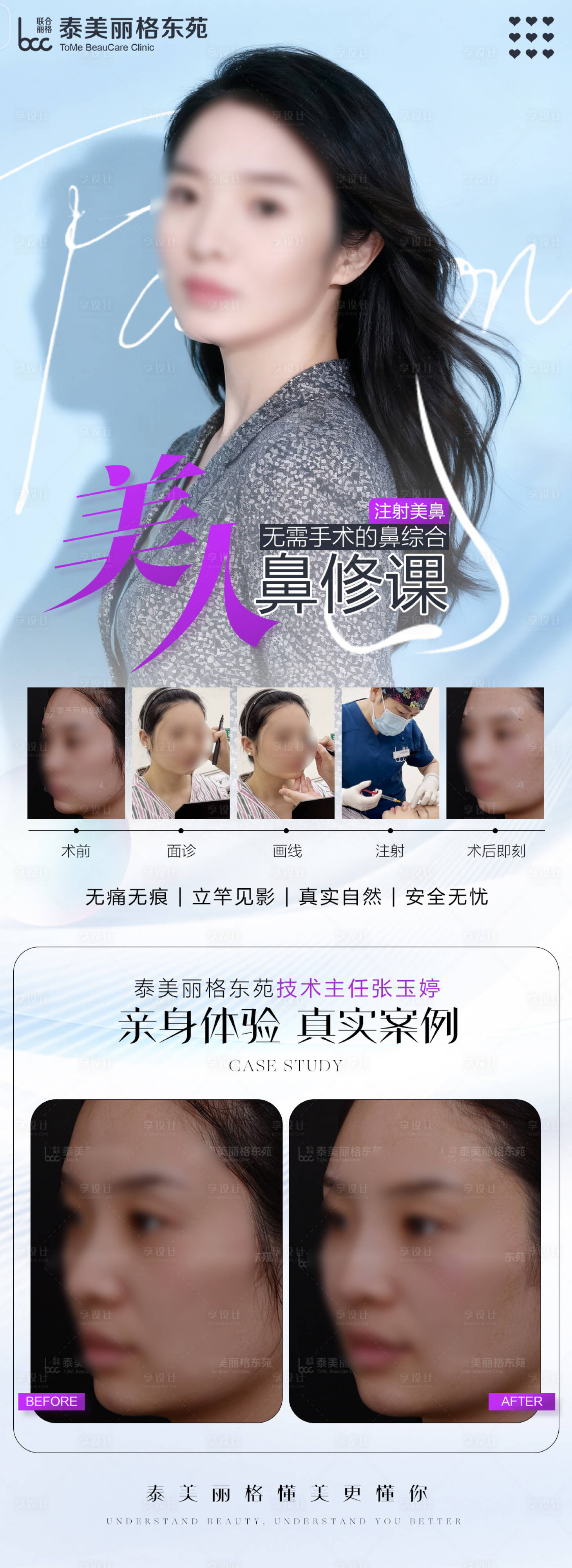 源文件下载【享设计】搜索编号：18560034113198291【医美鼻整形海报】