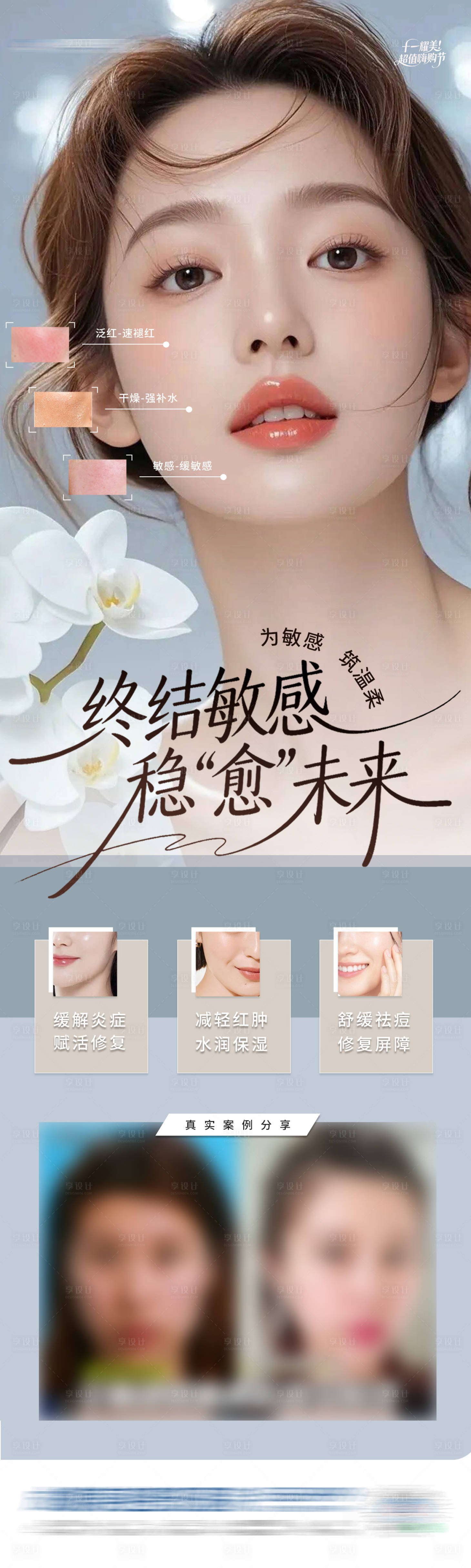 源文件下载【享设计】搜索编号：91730033912446941【医美敏感修复案例对比创意长图海报】