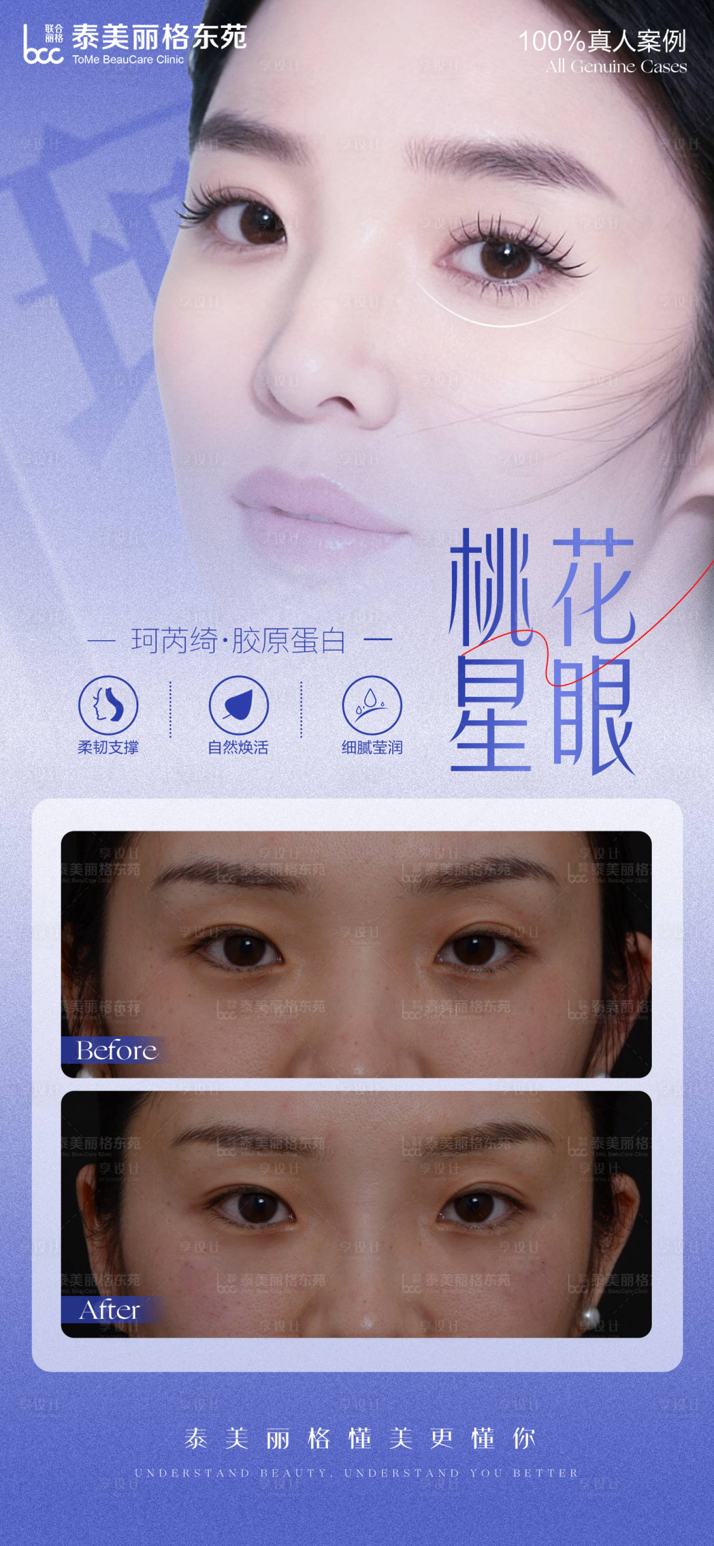 源文件下载【享设计】搜索编号：84360034126687952【医美眼整形海报】