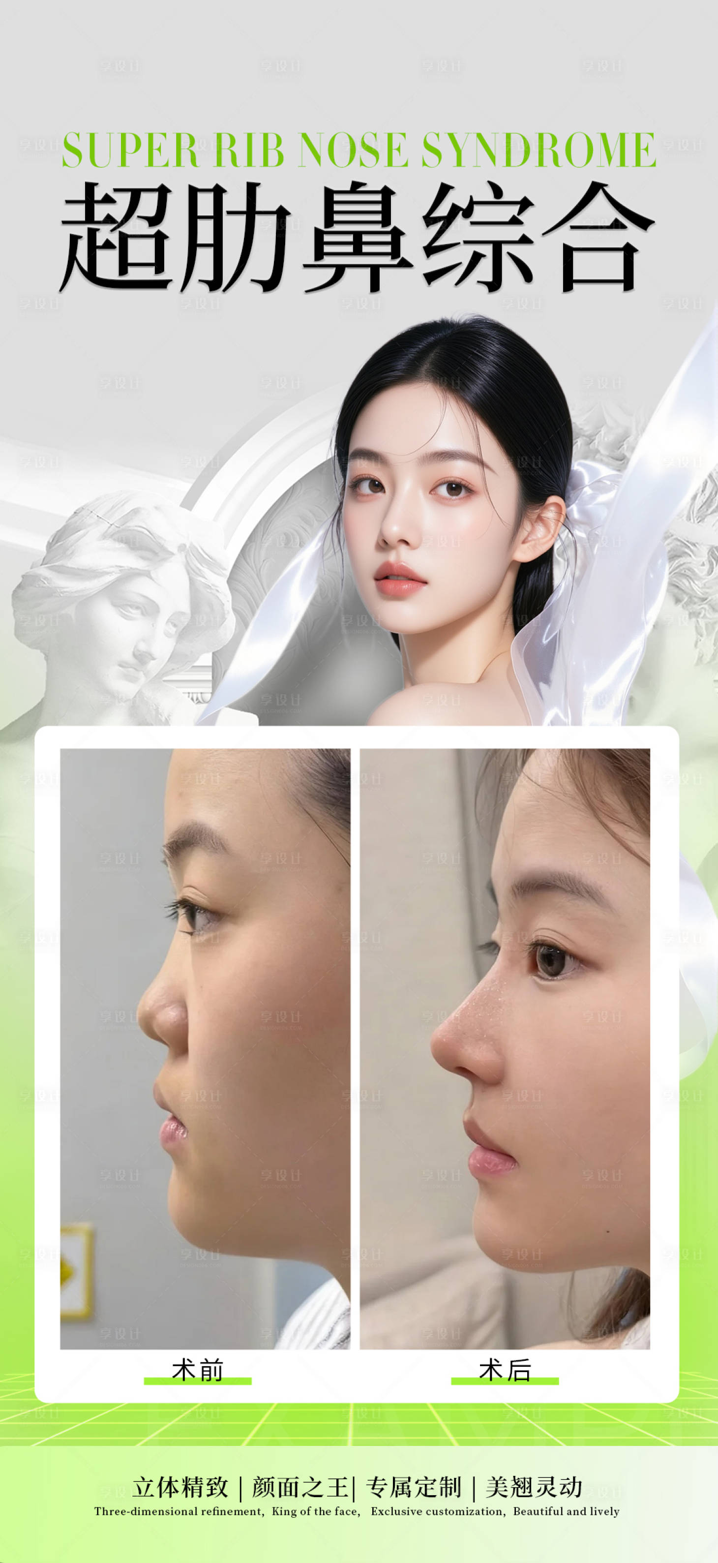 源文件下载【享设计】搜索编号：51420034198605972【超肋鼻综合】