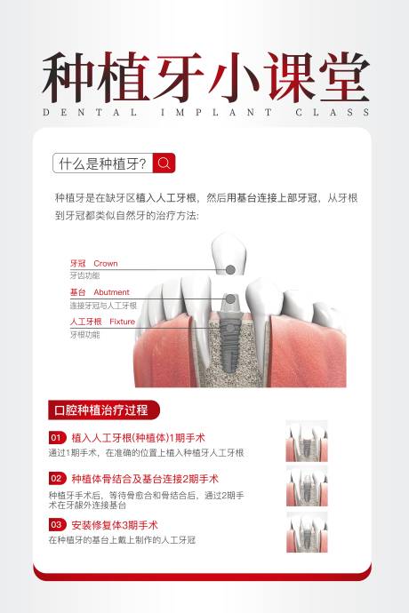 源文件下载【享设计】搜索编号：63970033921357705【种植牙简约科普海报】