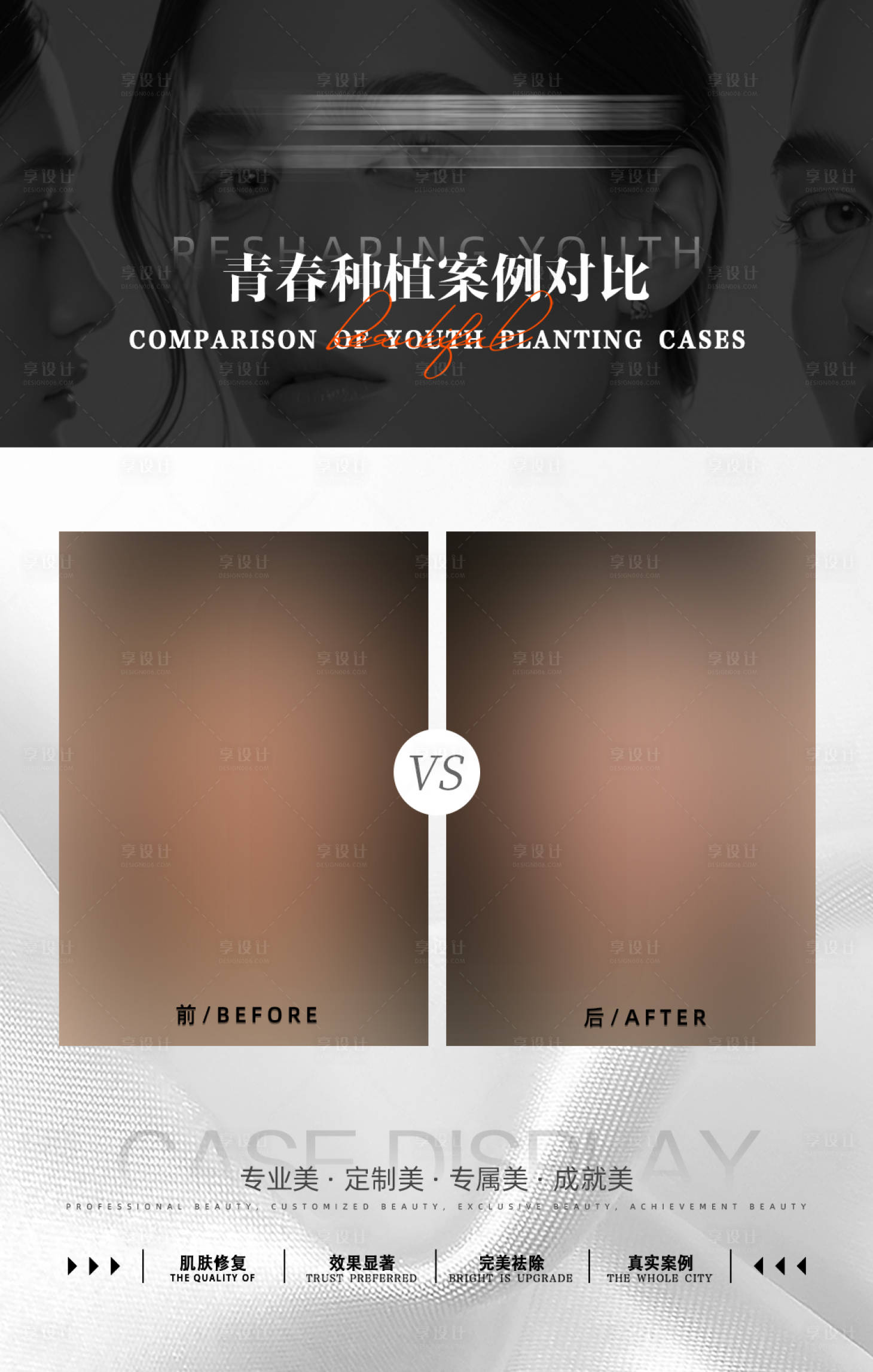 源文件下載【享設(shè)計(jì)】搜索編號(hào)：61790034055743630【醫(yī)美案例對(duì)比】