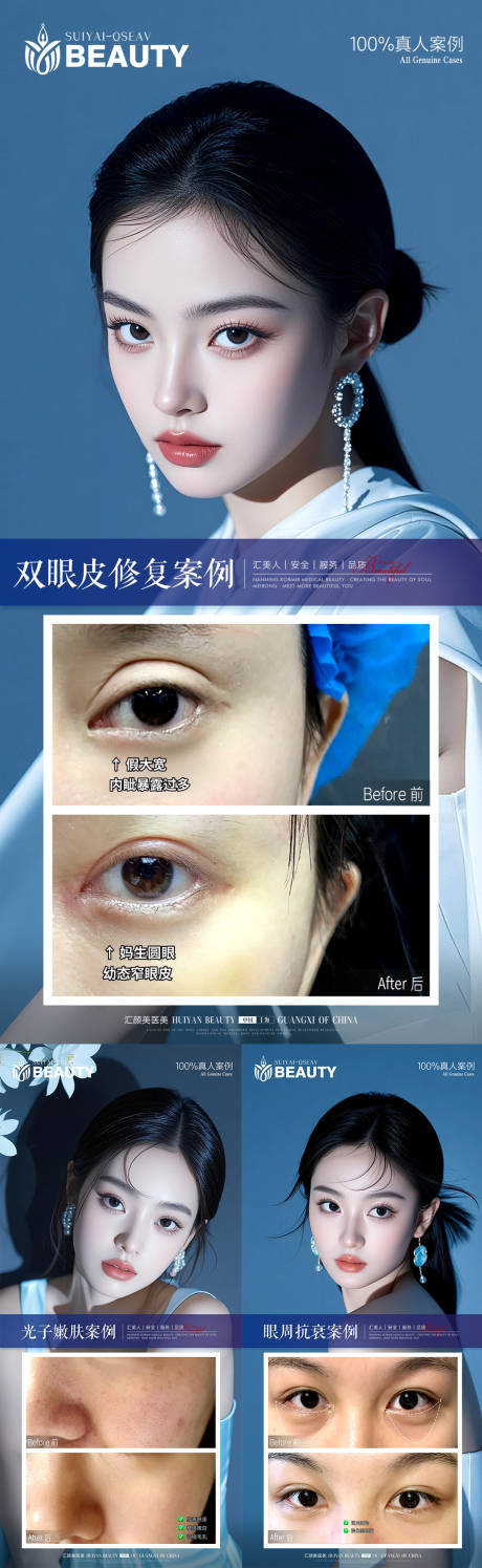 源文件下载【享设计】搜索编号：60480033946188151【医美案例】