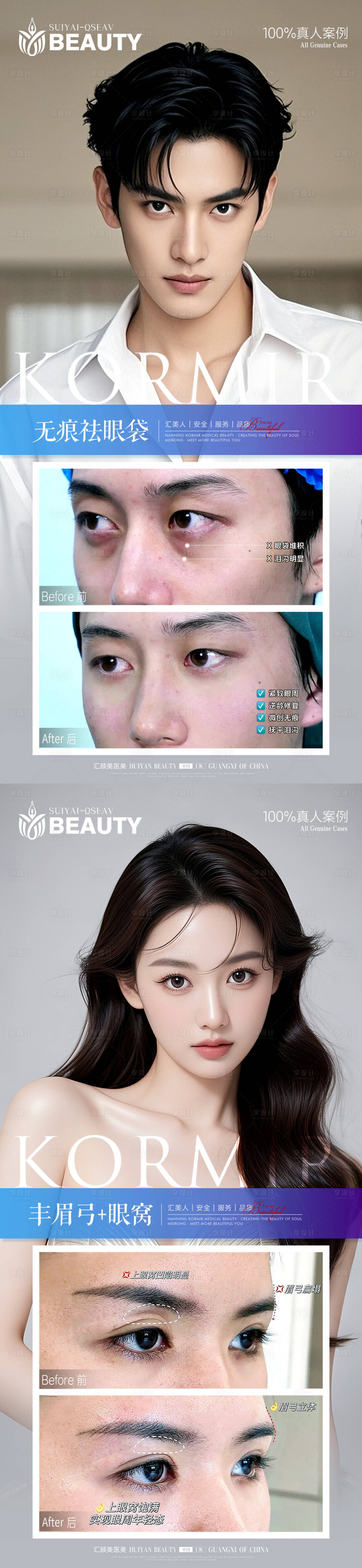 源文件下载【享设计】搜索编号：29470034111463178【医美案例对比海报】