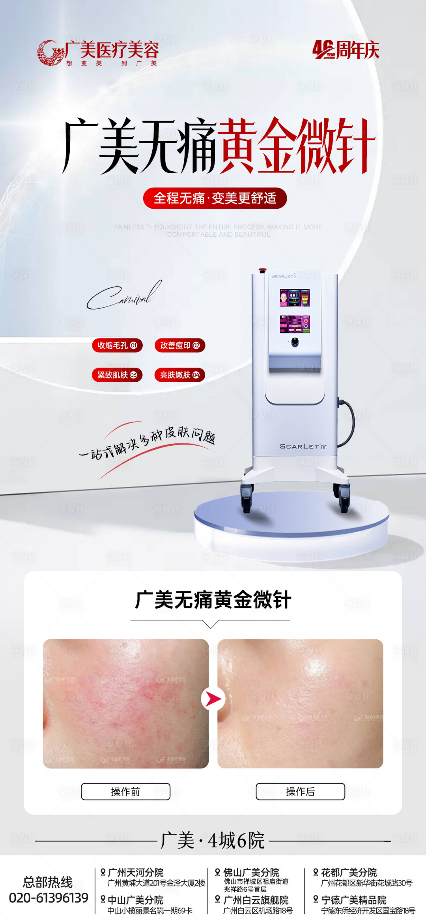 源文件下载【享设计】搜索编号：95340034011452003【黄金微针】