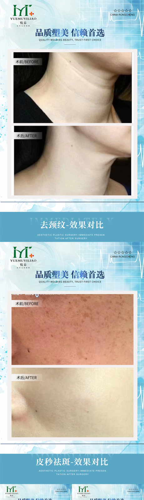 源文件下载【享设计】搜索编号：89760033979406456【医美案例】