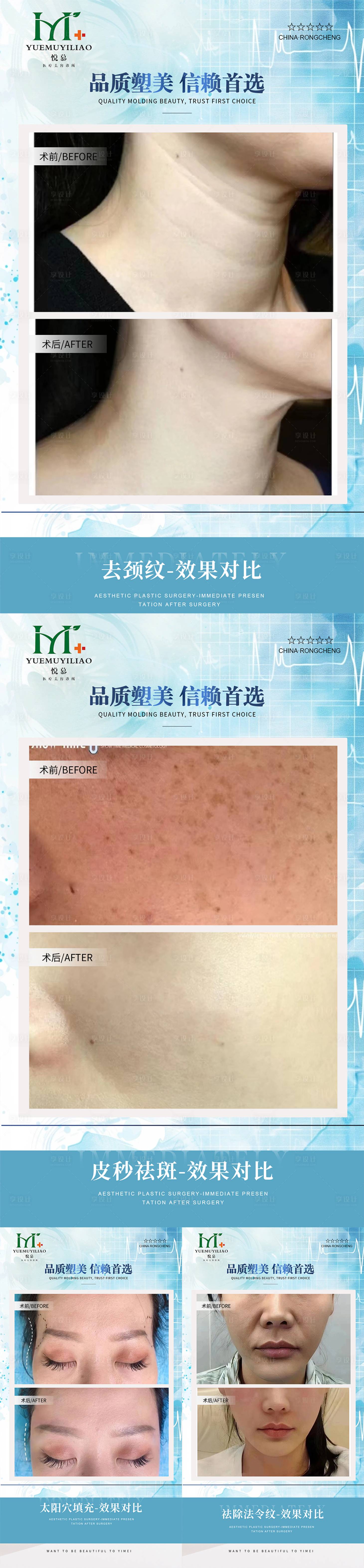 源文件下载【享设计】搜索编号：89760033979406456【医美案例】