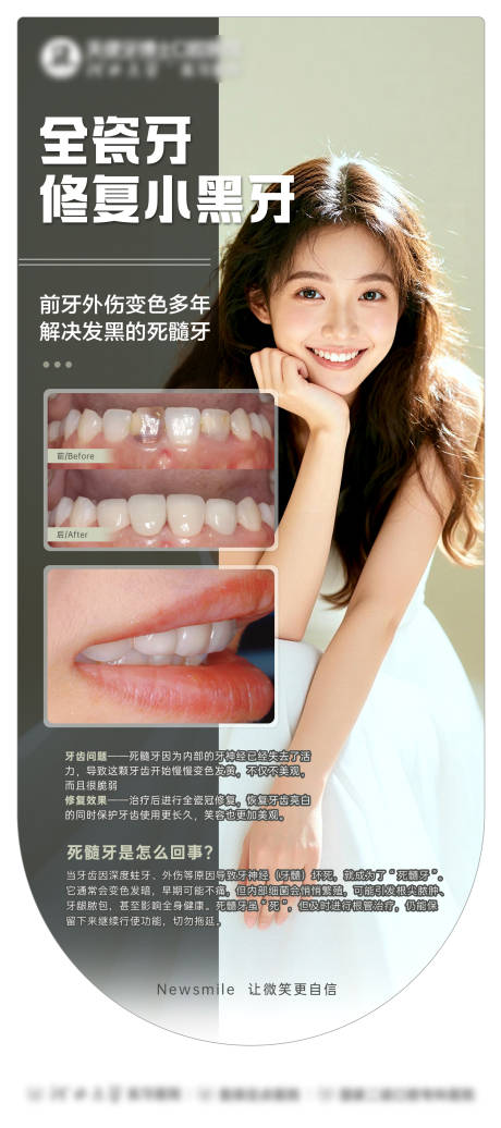 源文件下载【享设计】搜索编号：59550034118712193【口腔修复案例海报】