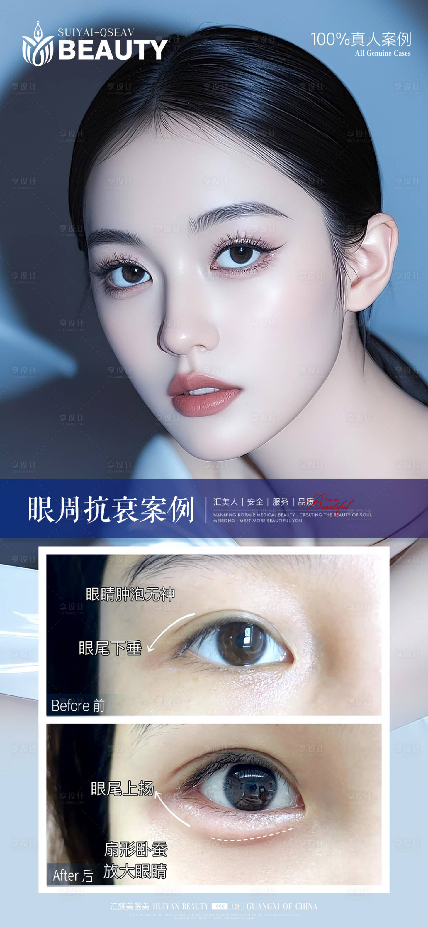 源文件下载【享设计】搜索编号：66280033925645950【眼周抗衰案例】