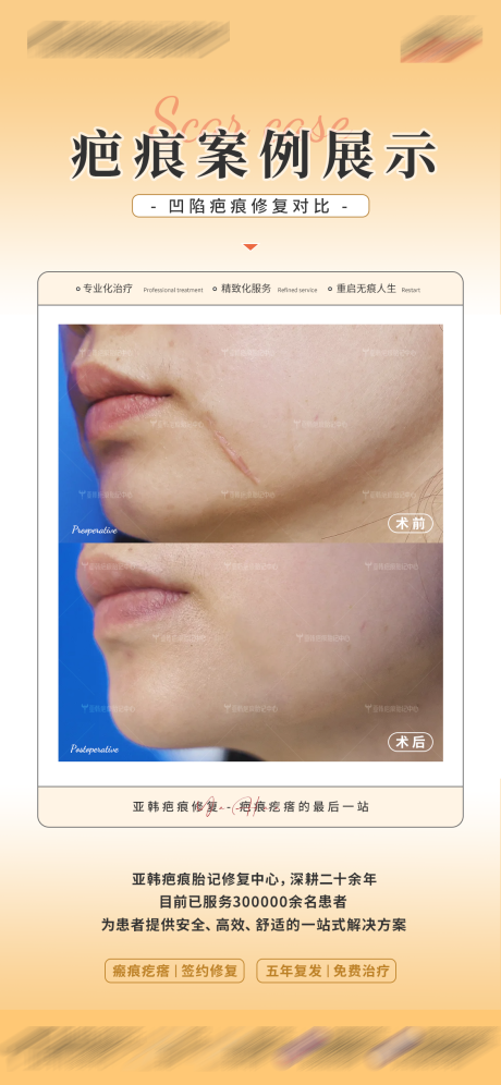 源文件下载【享设计】搜索编号：63990033974175184【疤痕案例对比海报】