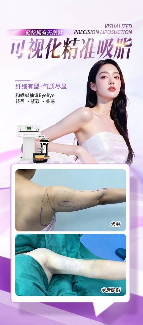 源文件下载【享设计】搜索编号：57230034101667895【可视化精准吸脂】