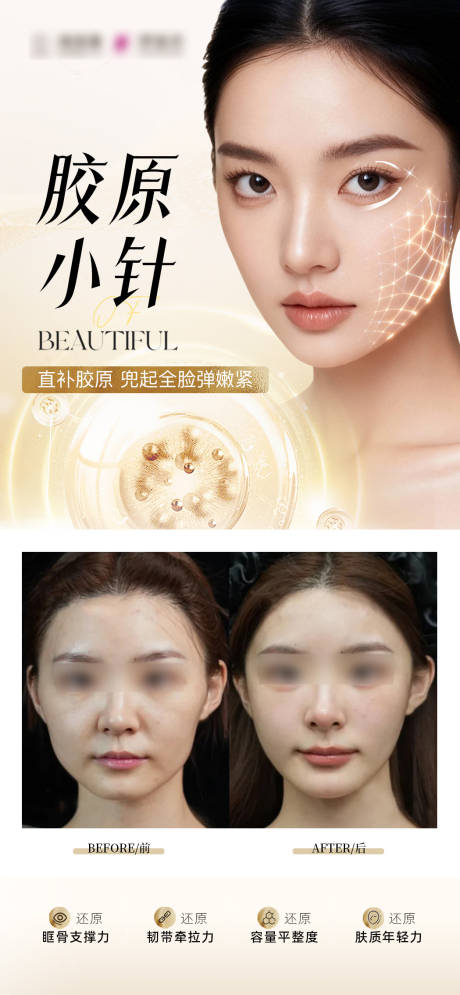 源文件下载【享设计】搜索编号：18580034399525335【医美胶原小针案例海报】