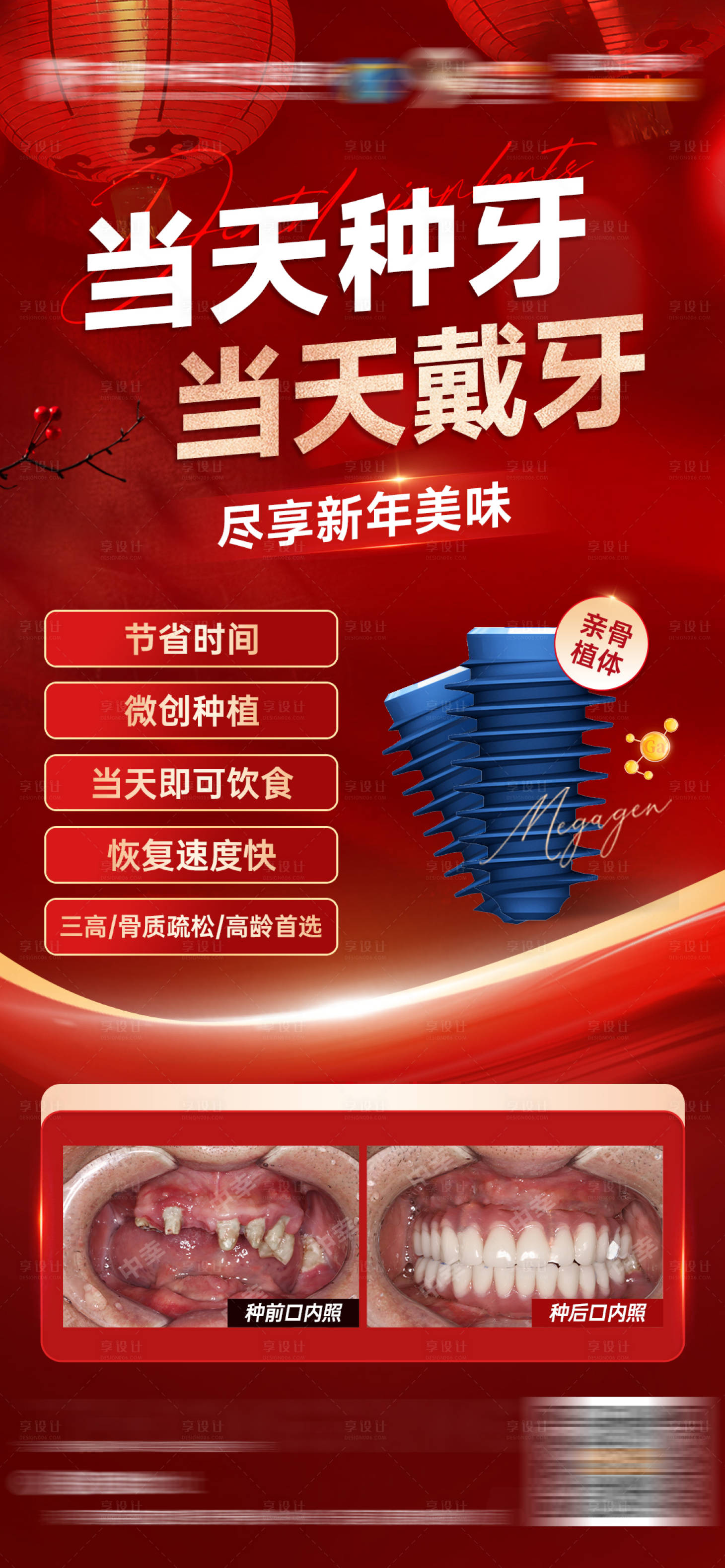 源文件下载【享设计】搜索编号：91730034567712862【当天种牙 】