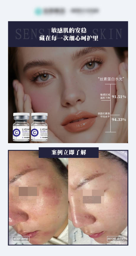 源文件下载【享设计】搜索编号：84550034662412093【医美修护屏障宣传海报】