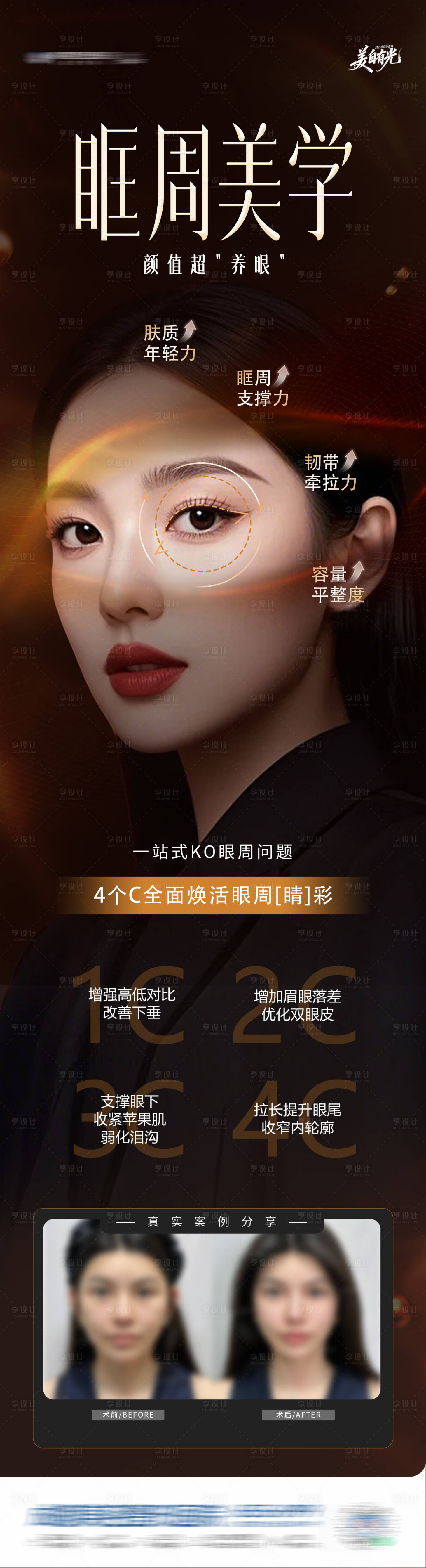 源文件下载【享设计】搜索编号：38430034665956518【医美眼睛眶周美学眼周抗衰案例创意海报】