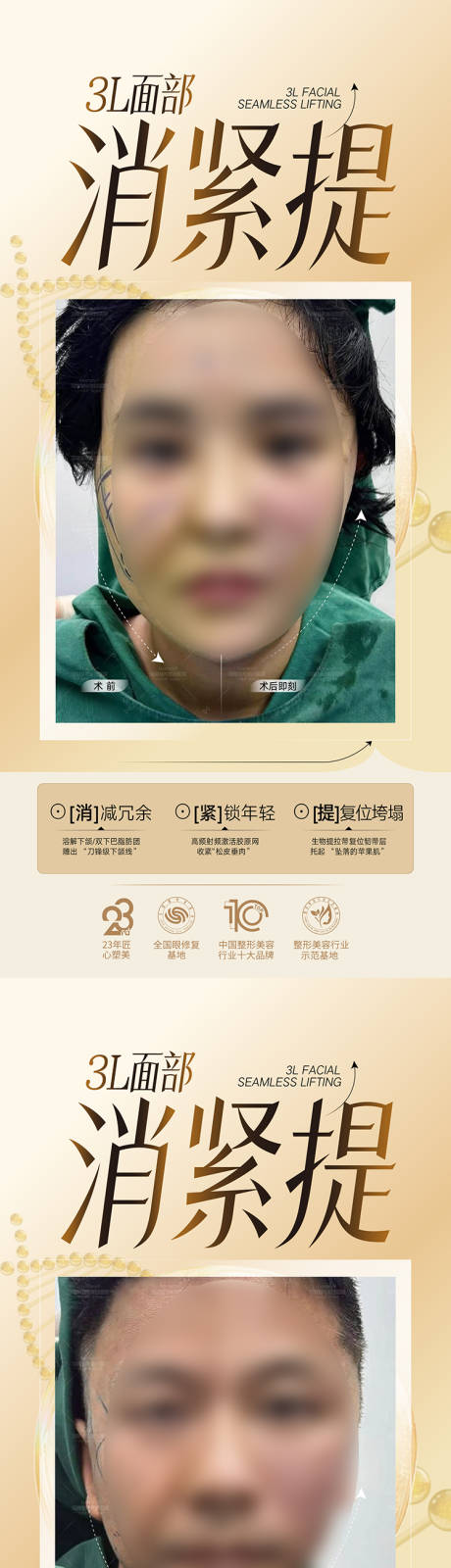 源文件下载【享设计】搜索编号：27220034405617078【整形美容专家医美海报  】