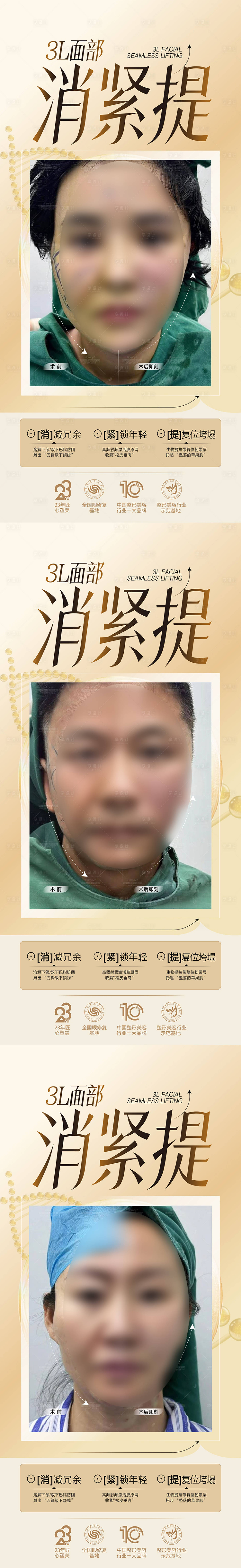 源文件下载【享设计】搜索编号：27220034405617078【整形美容专家医美海报  】