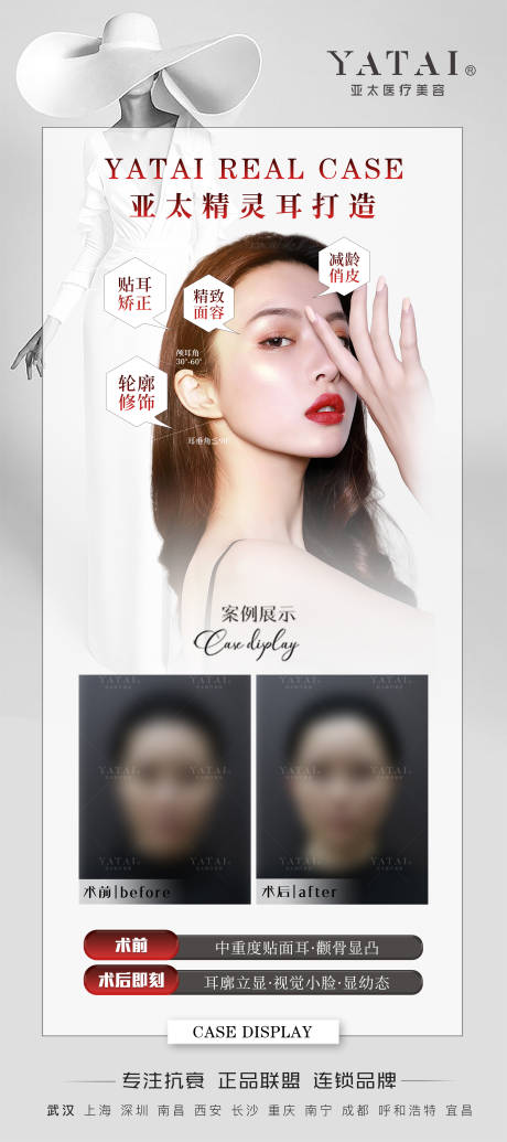 源文件下载【享设计】搜索编号：84780034765683258【医美案例对比人物展架】