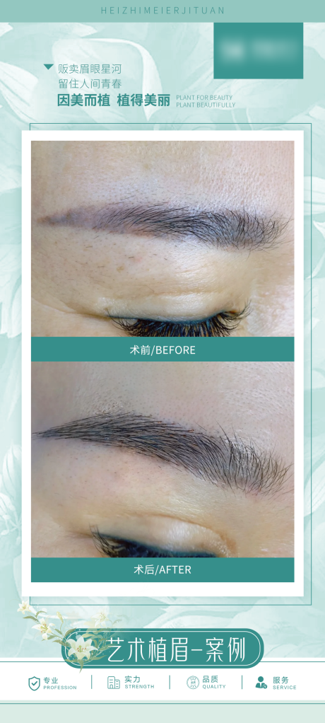 源文件下载【享设计】搜索编号：50280034641864343【医美眉毛案例海报】
