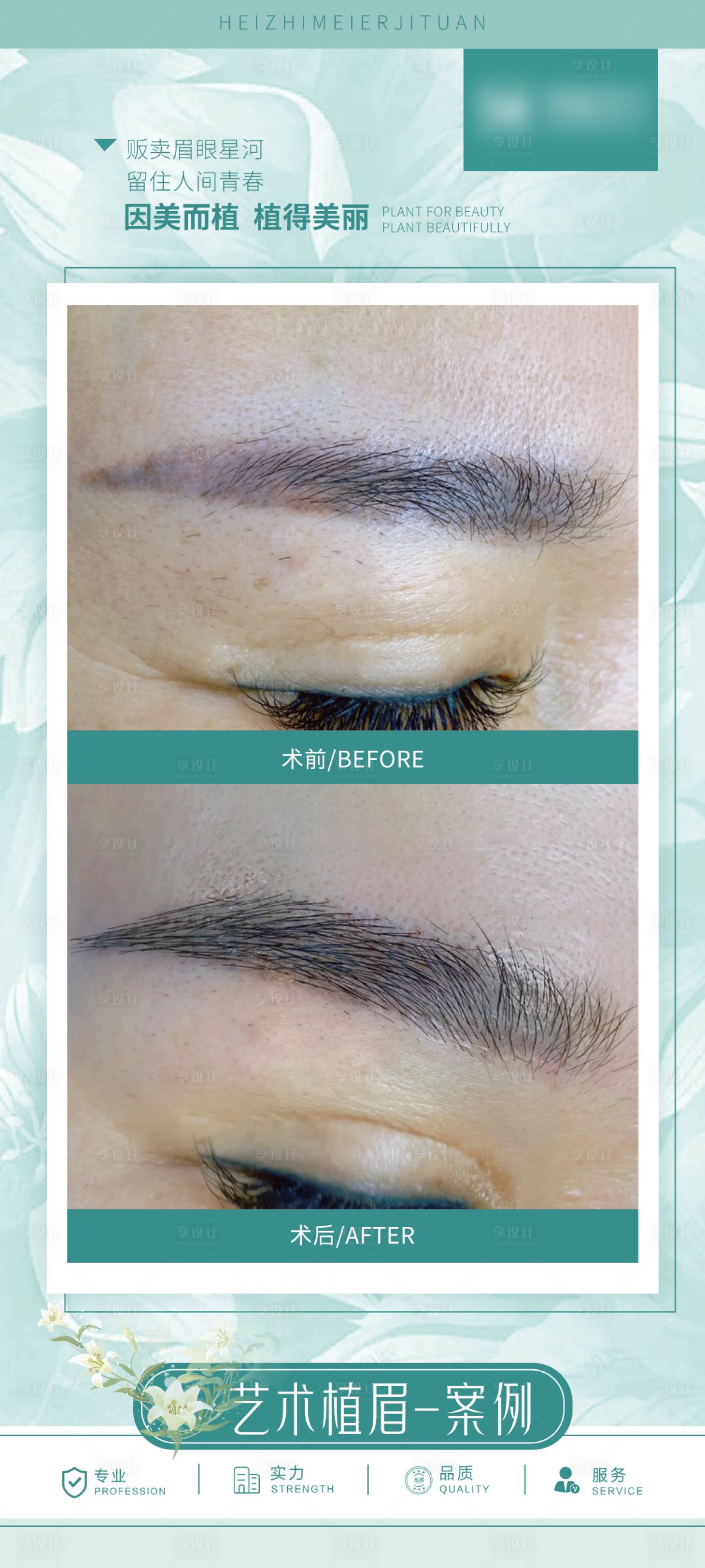 源文件下载【享设计】搜索编号：50280034641864343【医美眉毛案例海报】