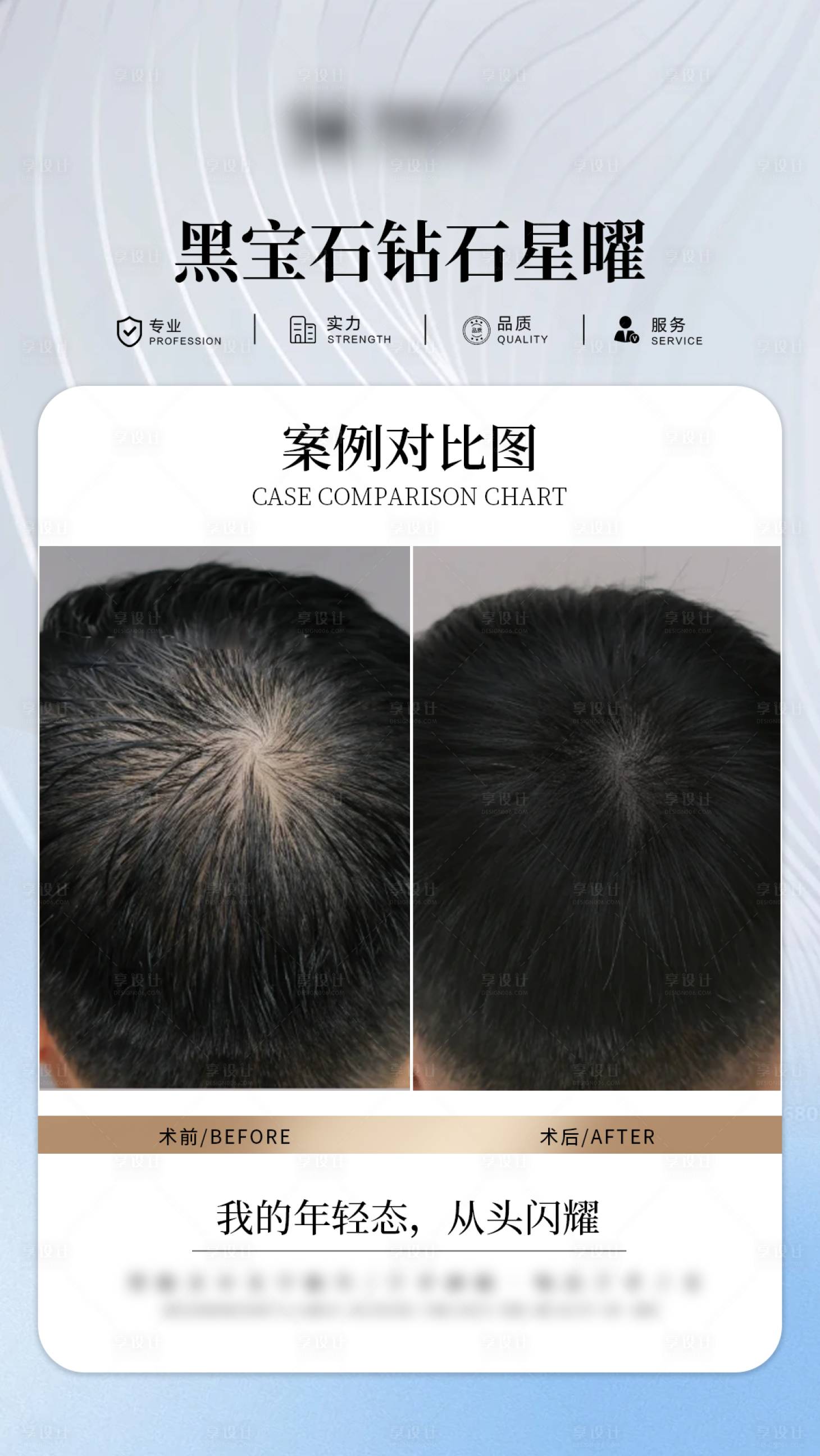 源文件下载【享设计】搜索编号：79740034474639886【医美头皮抗衰案例海报】