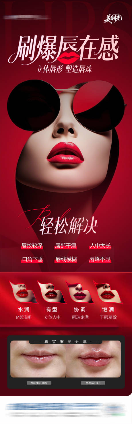 源文件下载【享设计】搜索编号：16690034376781118【医美唇部塑形嘴唇案例创意海报】