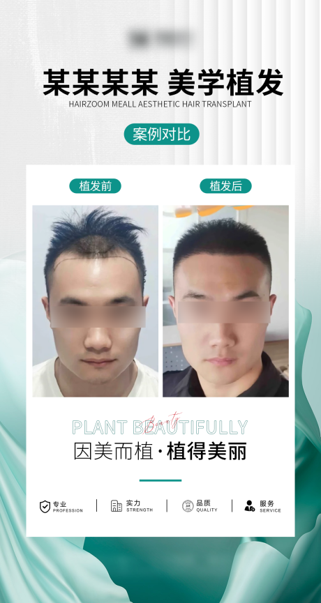 源文件下载【享设计】搜索编号：85320034523815387【植发男士案例】