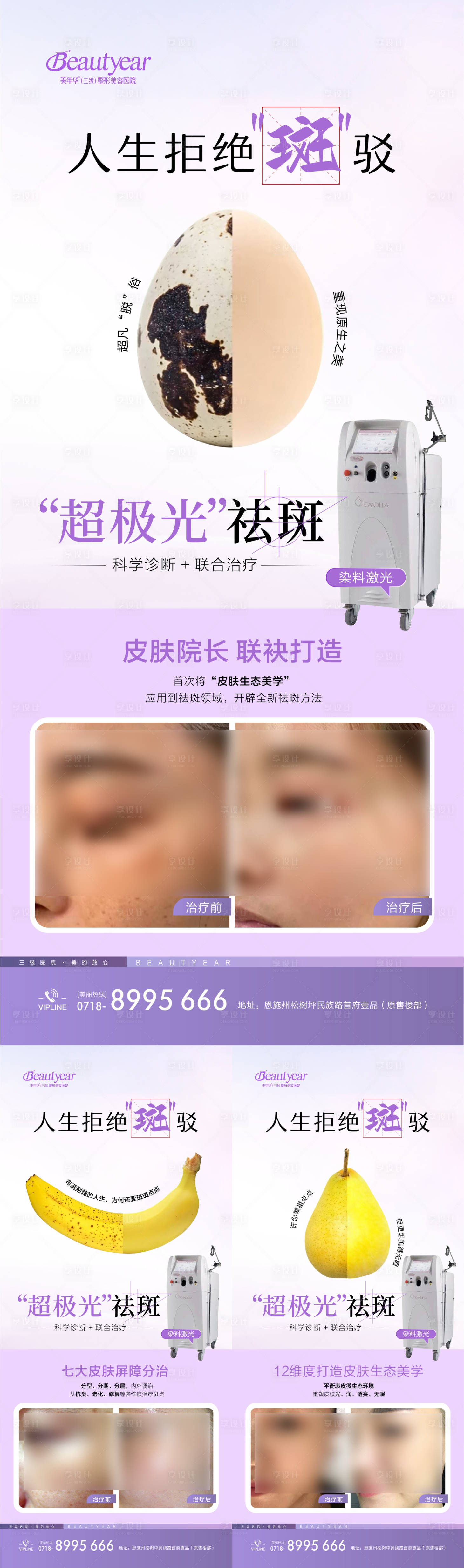 源文件下载【享设计】搜索编号：61550034557432653【医美祛斑海报】