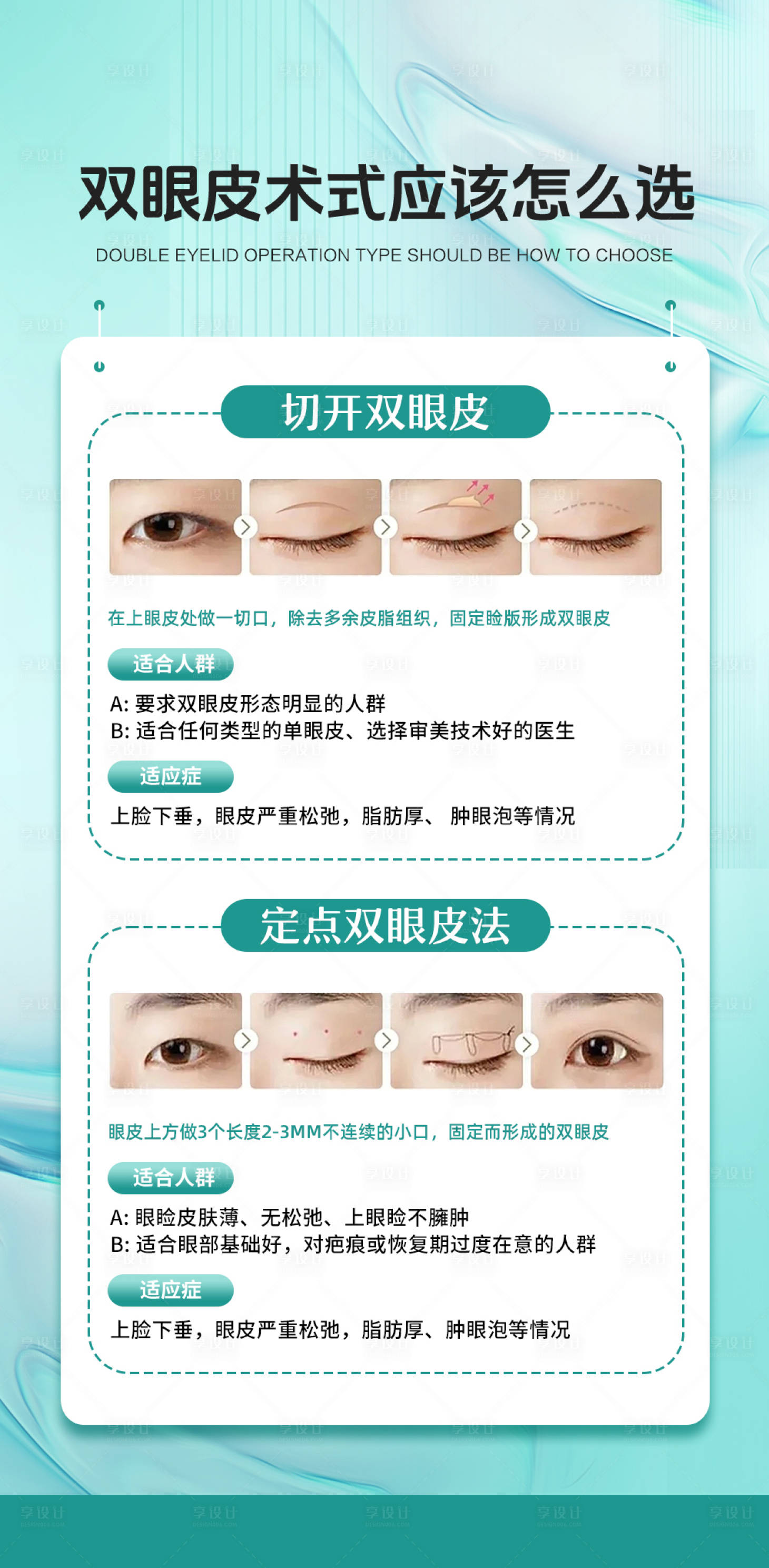 源文件下载【享设计】搜索编号：20790034341064590【双眼皮术式怎么选】