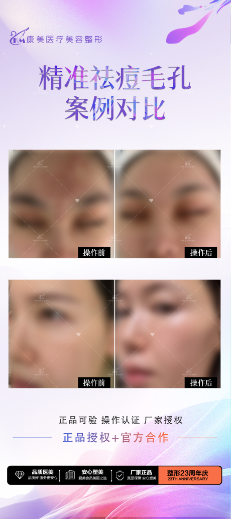 源文件下载【享设计】搜索编号：95030034340285670【案例对比祛痘毛孔】