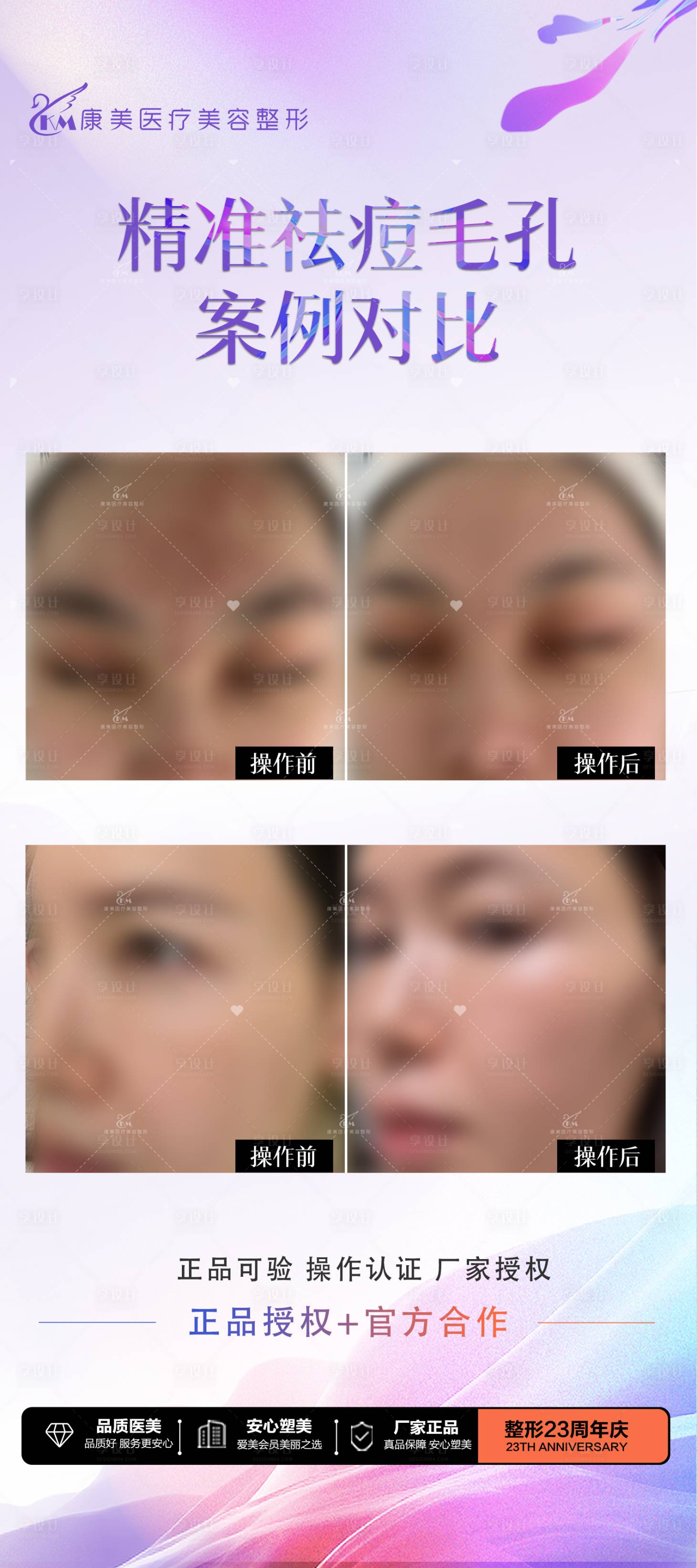 源文件下载【享设计】搜索编号：95030034340285670【案例对比祛痘毛孔】