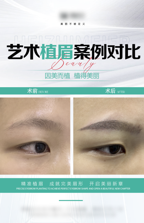 源文件下载【享设计】搜索编号：74820034661008056【医美眉毛案例海报】