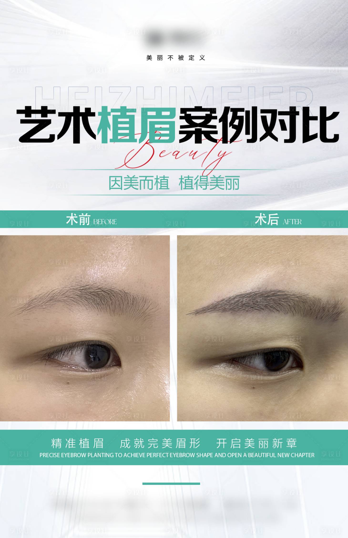 源文件下载【享设计】搜索编号：74820034661008056【医美眉毛案例海报】