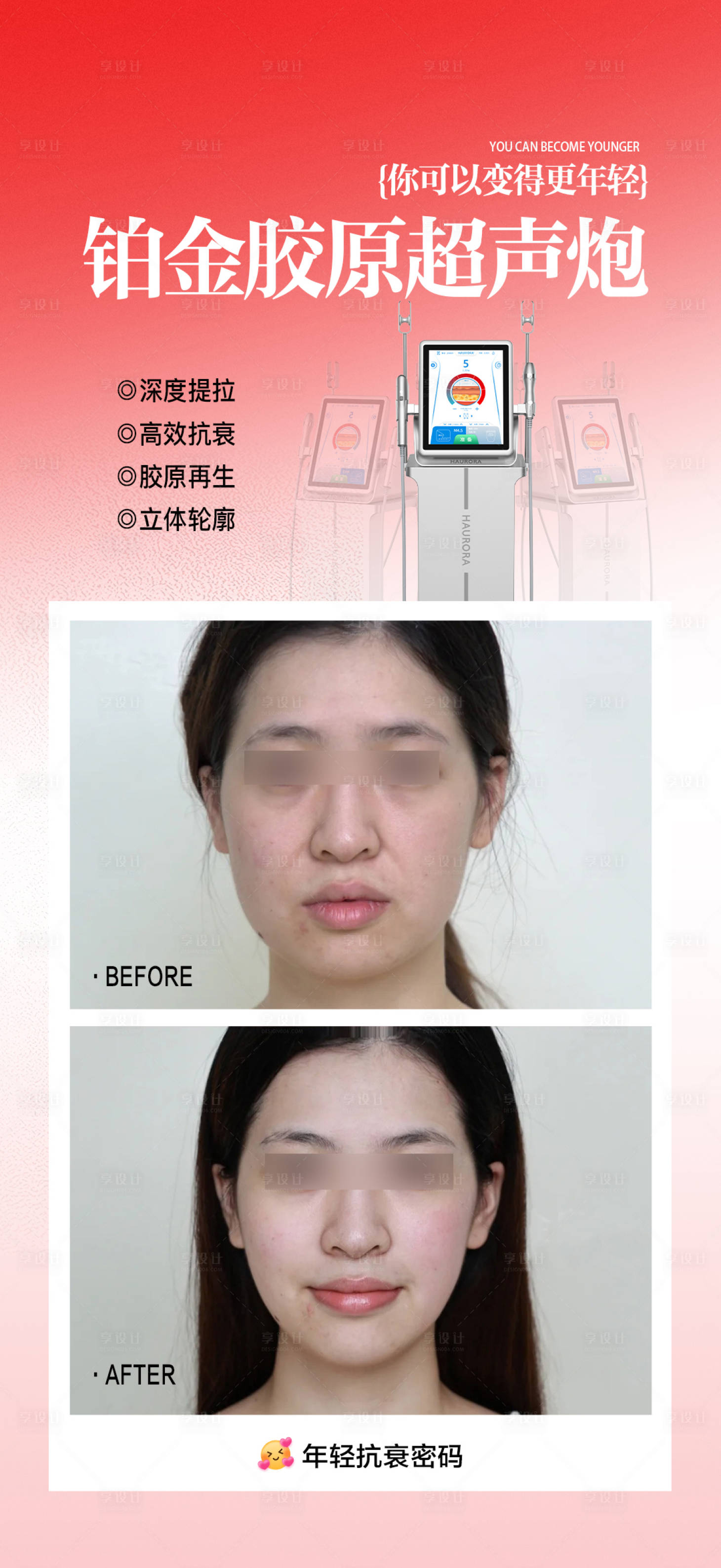 源文件下载【享设计】搜索编号：33800034799958101【铂金胶原超声炮海报】