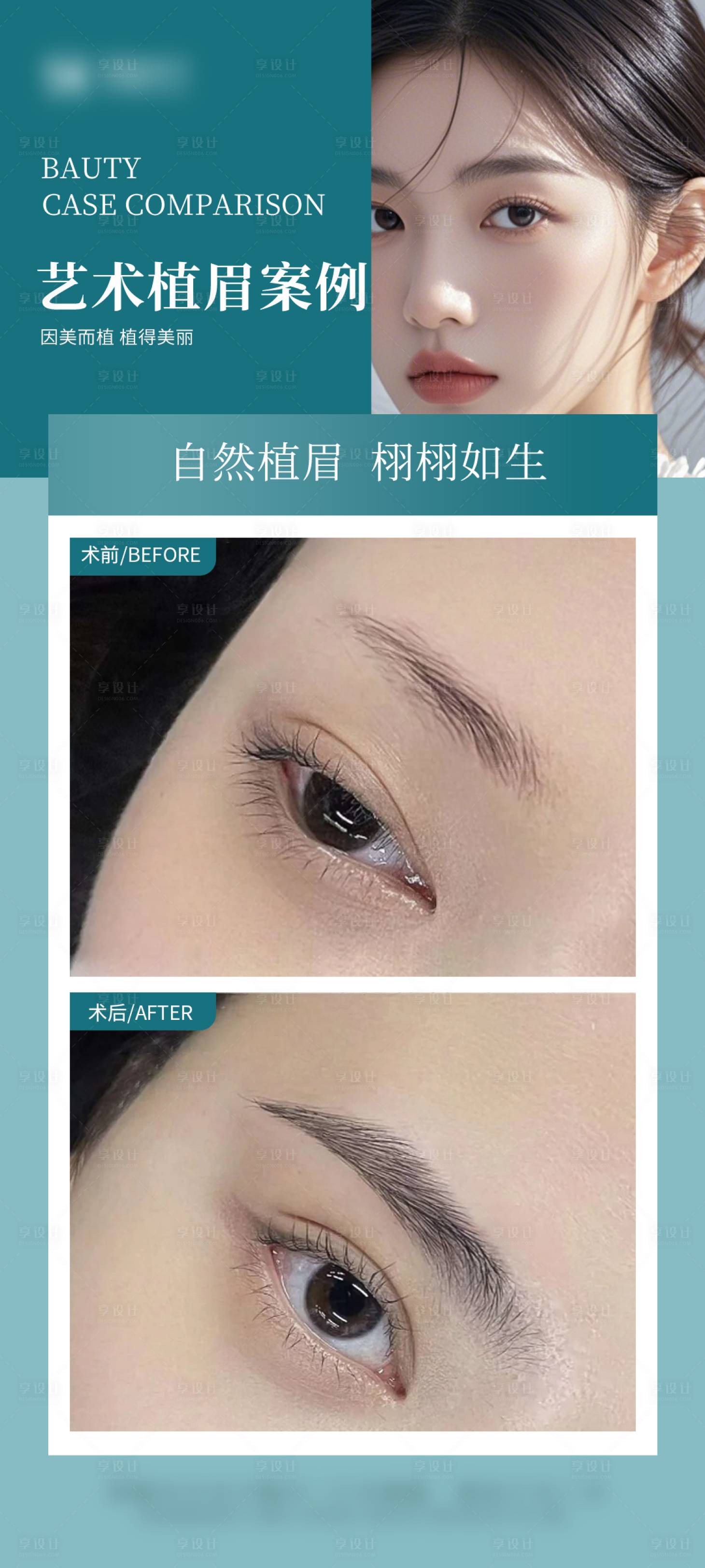 源文件下载【享设计】搜索编号：33240034641828774【医美眉毛案例海报】