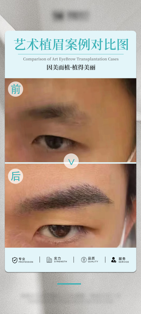 源文件下载【享设计】搜索编号：35130034660923113【医美眉毛案例宣传海报】