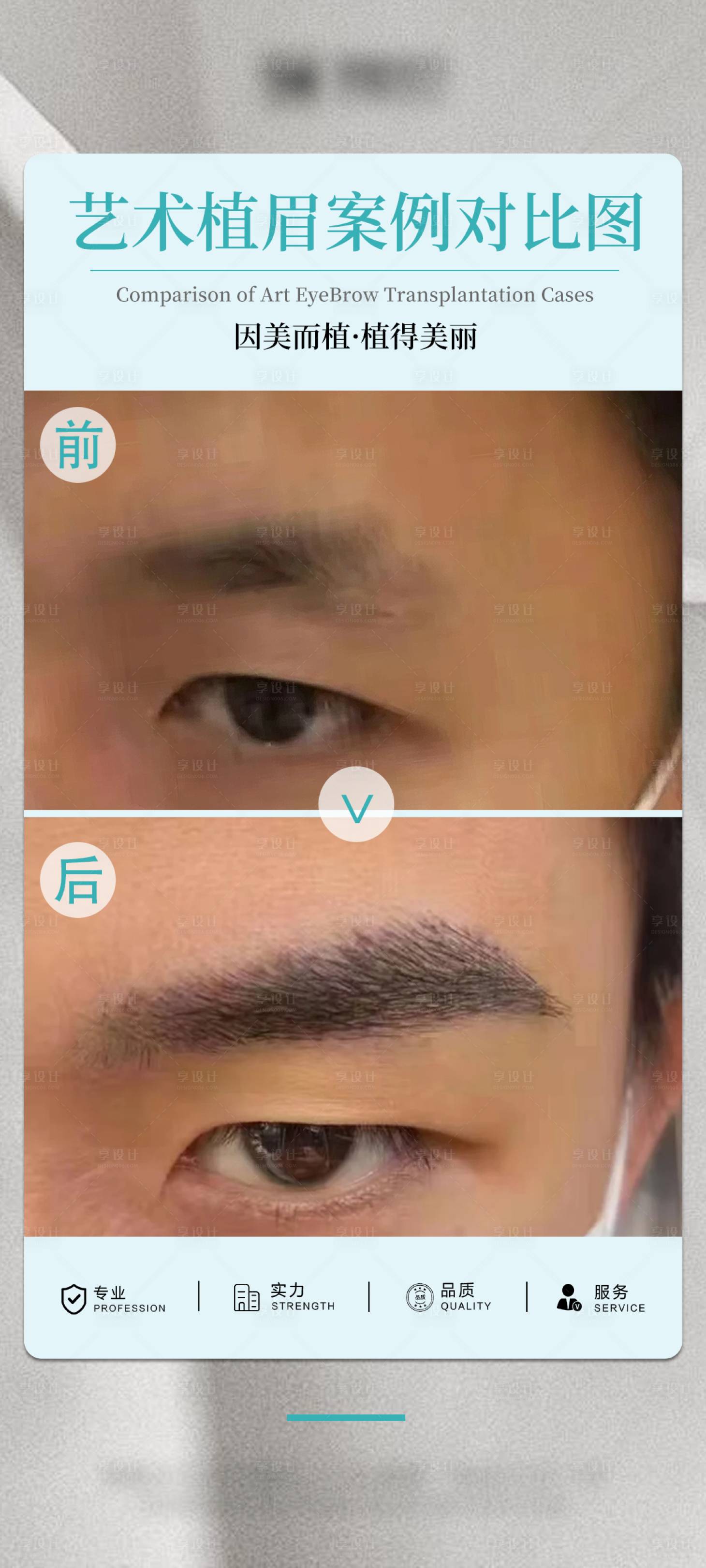 源文件下载【享设计】搜索编号：35130034660923113【医美眉毛案例宣传海报】