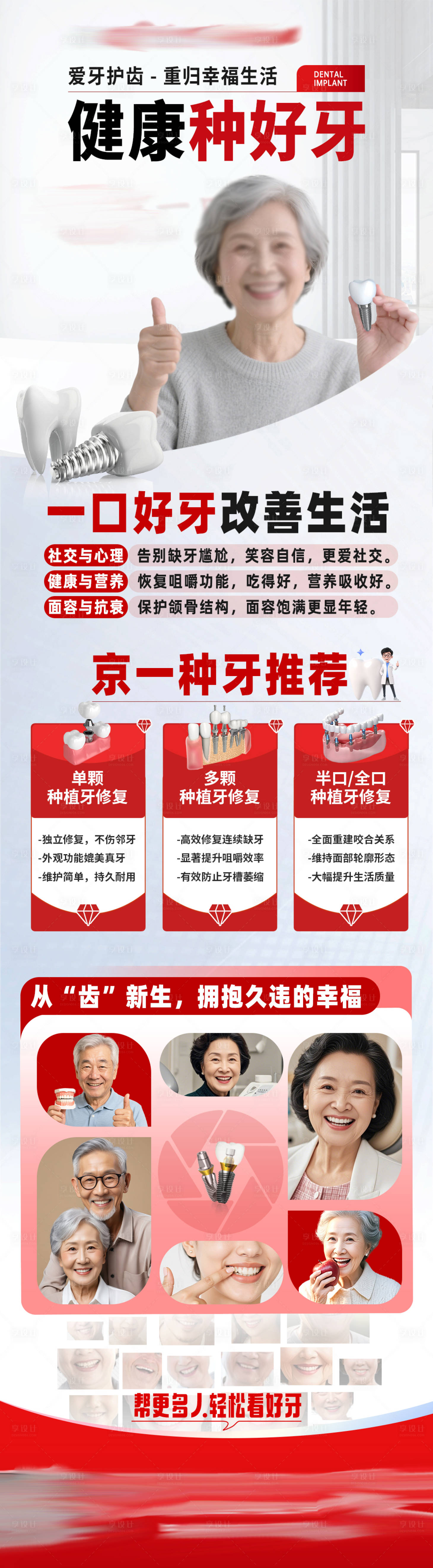 源文件下載【享設(shè)計(jì)】搜索編號：99590034372438168【種植牙口腔長圖海報(bào)】