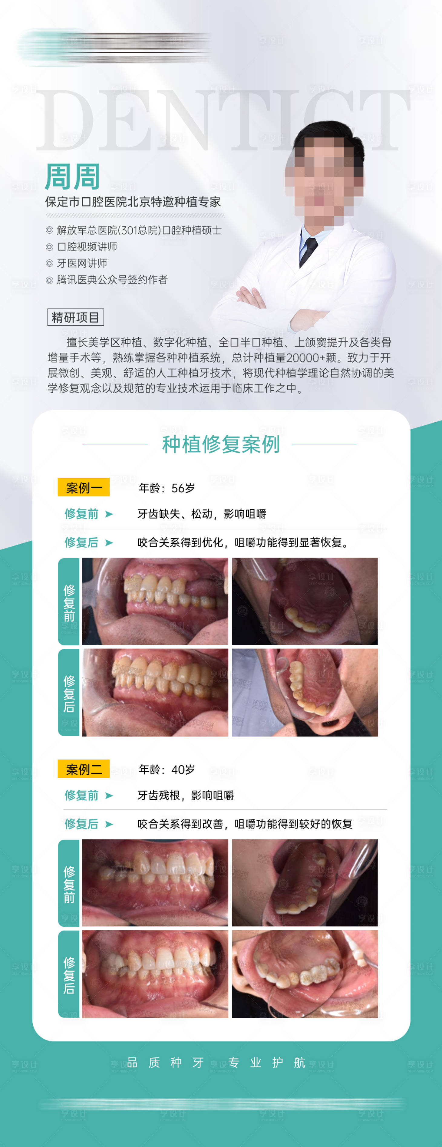 源文件下載【享設計】搜索編號：57110034380425965【種植牙案例分享海報】